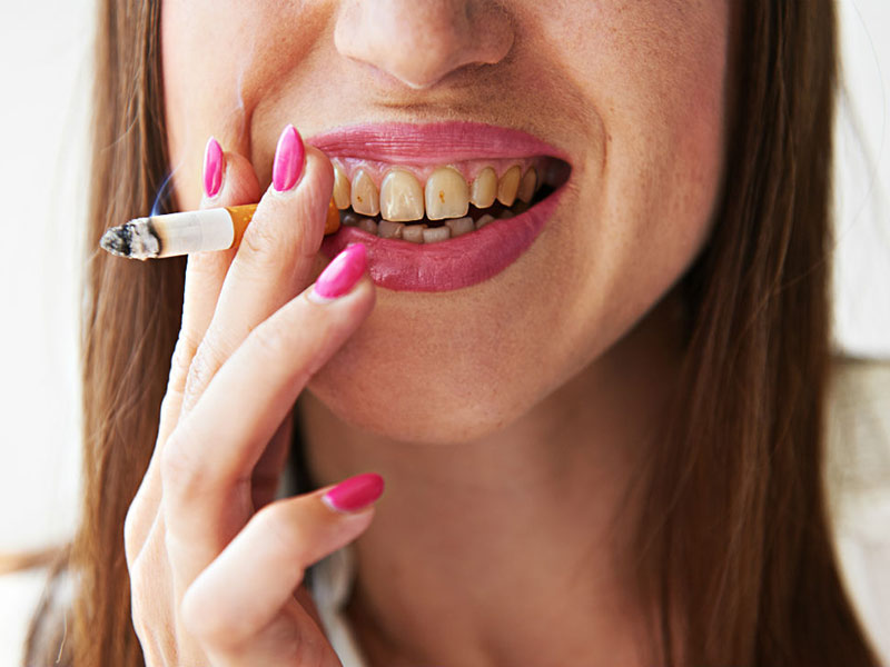 What Does Smoking Do to Your Teeth? - Wesley Dentistry