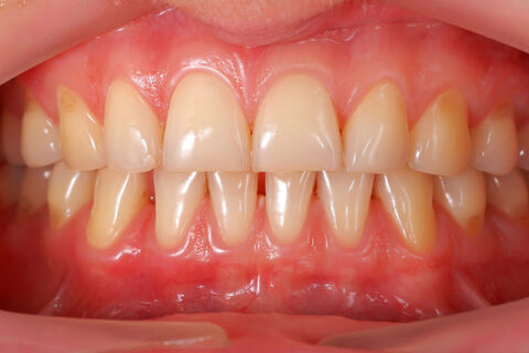 closeup image of a healthy teeth